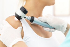 Skin cancer check, dermatologist