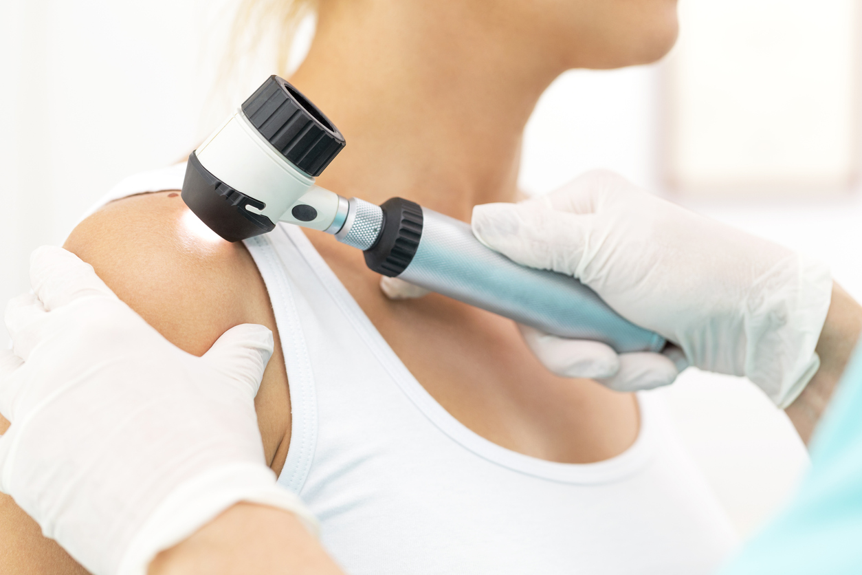 Skin cancer check, dermatologist