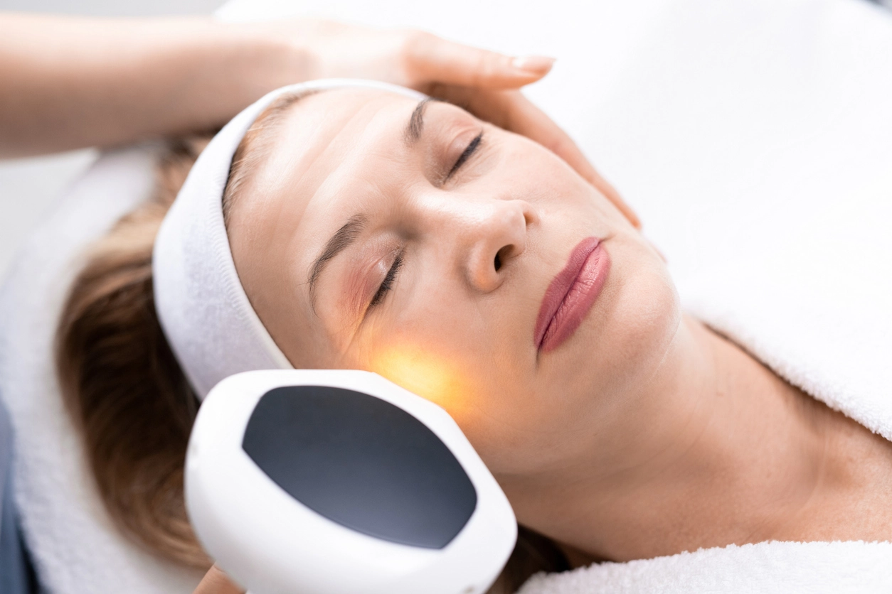 Look younger fast with laser resurfacing