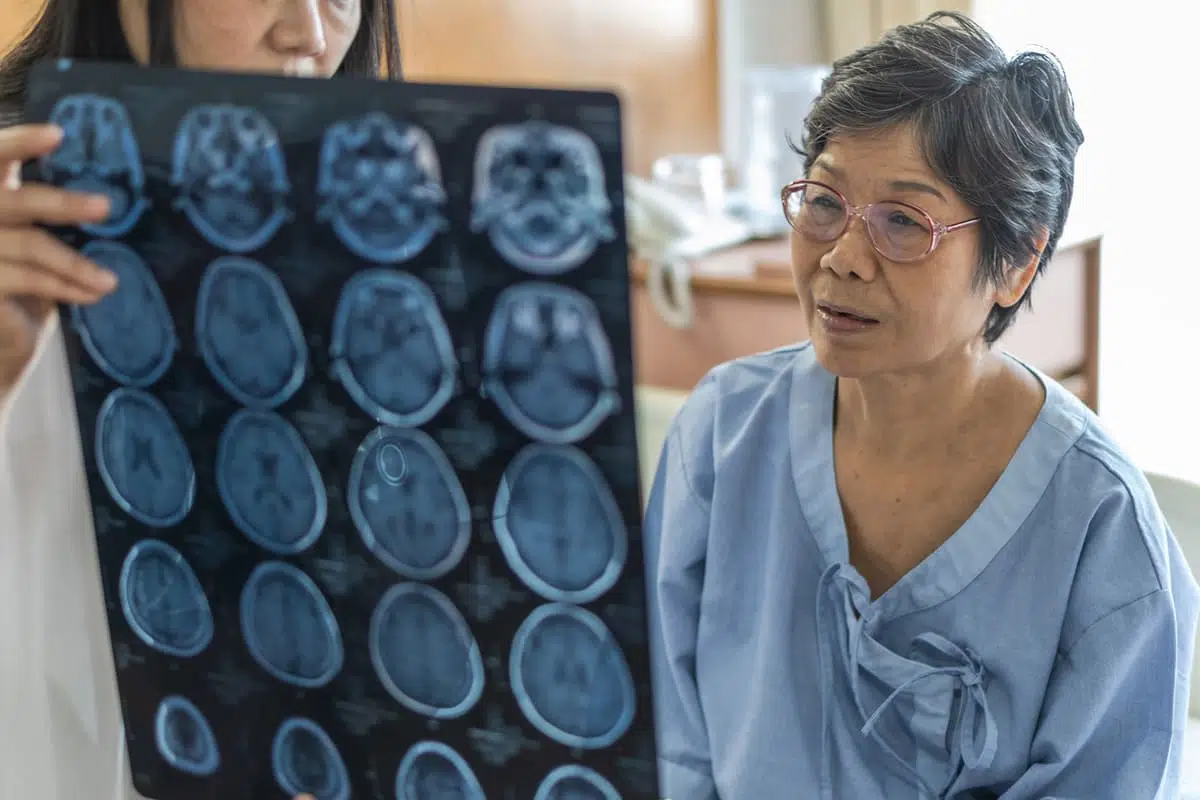 Alzhemers doctor