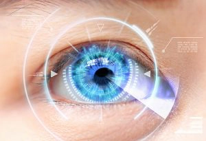 cataract surgery