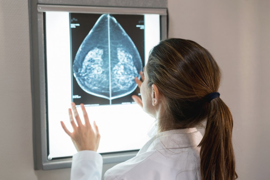Doctor Looking at Mammogram