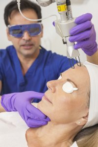 Radiofrequency laser treatment for acne