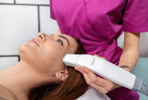 Radiofrequency laser treatment for acne