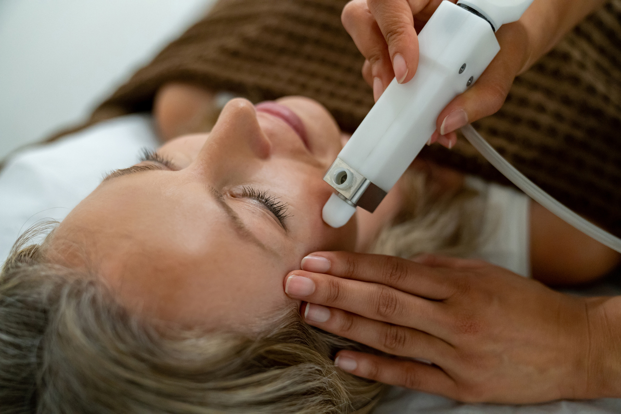 Microdermabrasion Benefits