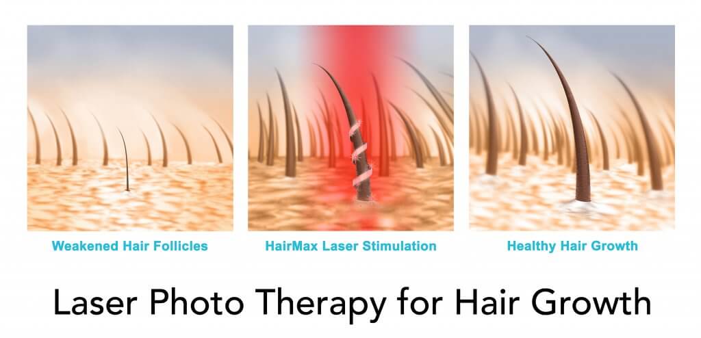 hm_stimulation-graphic_3frames_flesh_TEXT_v2