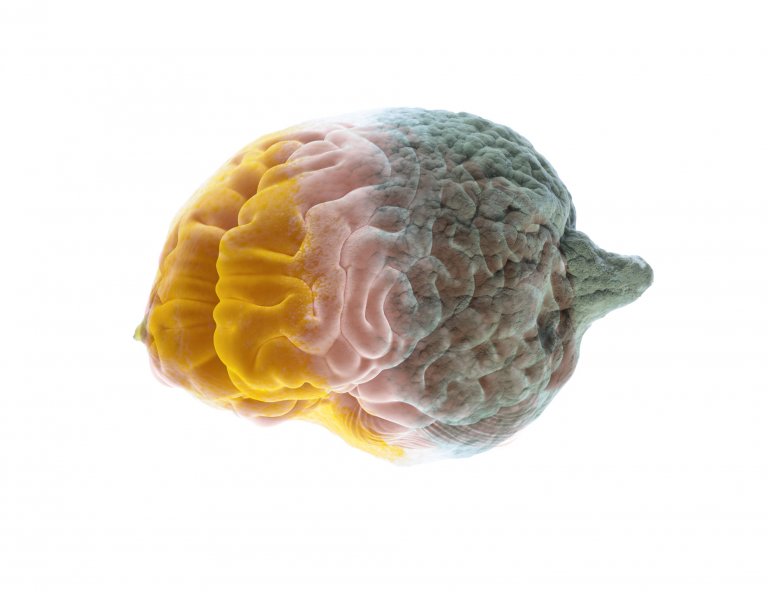 Chemo Brain