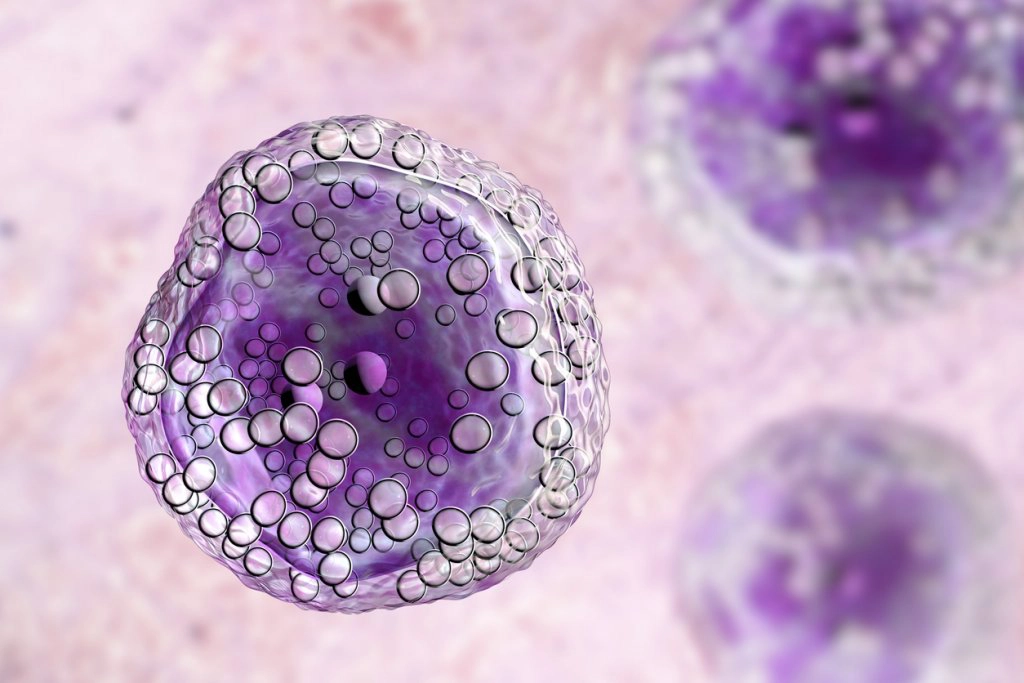 Cancer Fighting Foods May Save Your Life