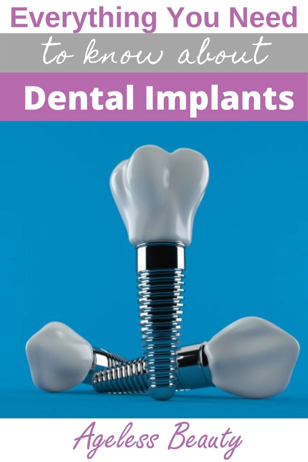 Everything you need to know about dental implants