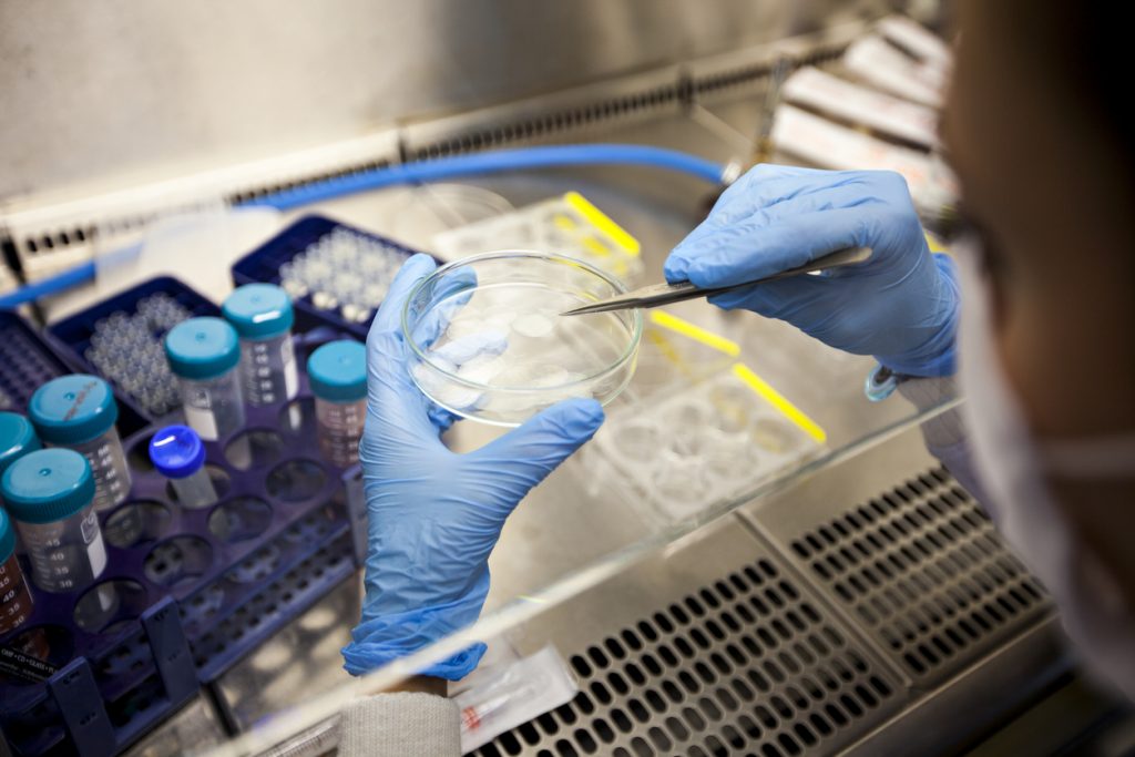 Doctors use stem cells from the patient for this therapy, which reduces the risk of rejection.