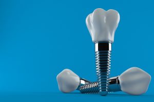 One of the types of dental implants come in two pieces. The screw (implant) and the crown that covers it. 