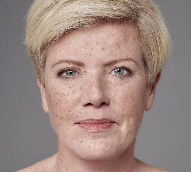 Jo Howell was featured in the Daily Mail --for her freckles!