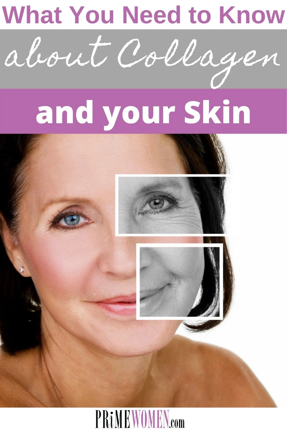 What you need to know about collagen and your skin