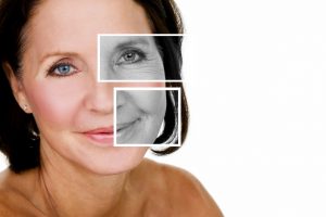 Collagen supplements can help you fight the signs of aging.