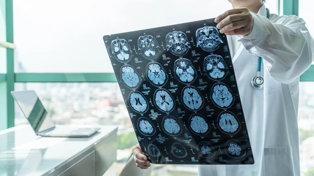 dementia or brain scan