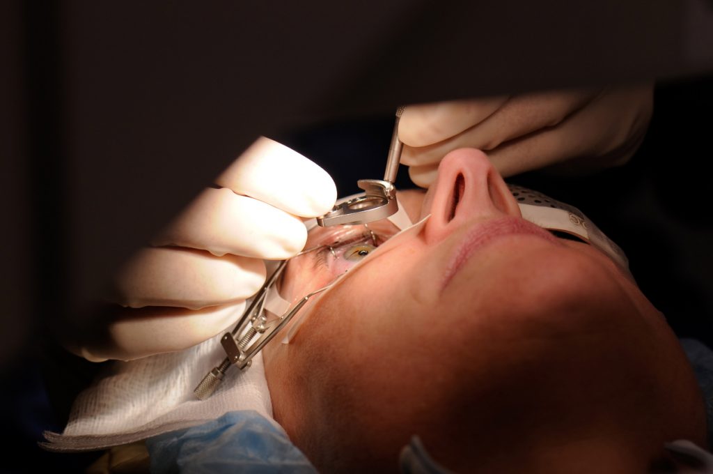 intraocular lens implant surgery