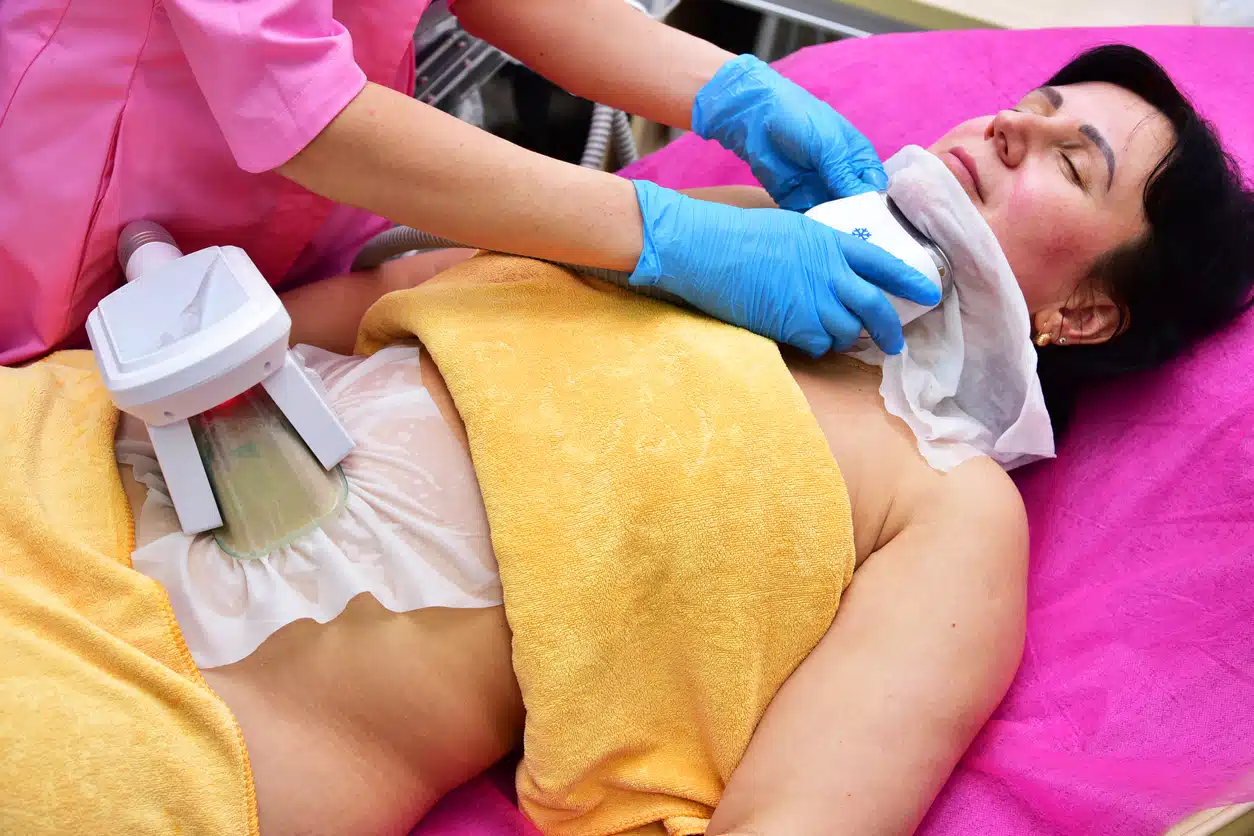 Coolsculpting on neck or chin