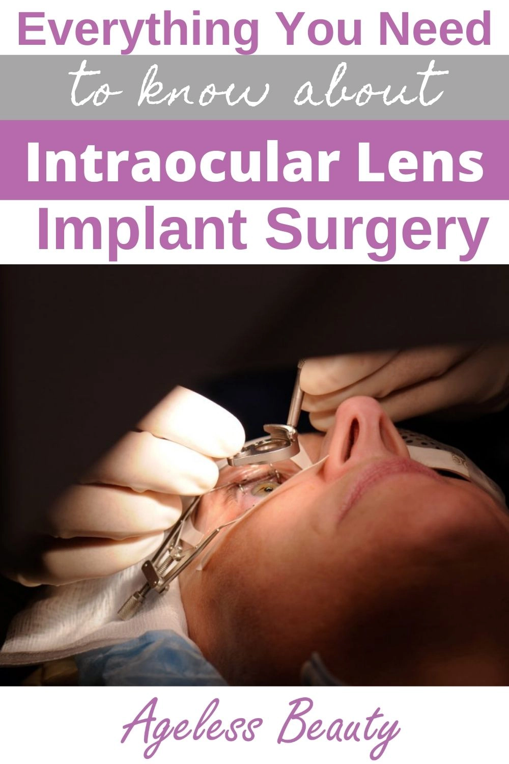 Everything you need to know about Intraocular Lens Implant Surgery