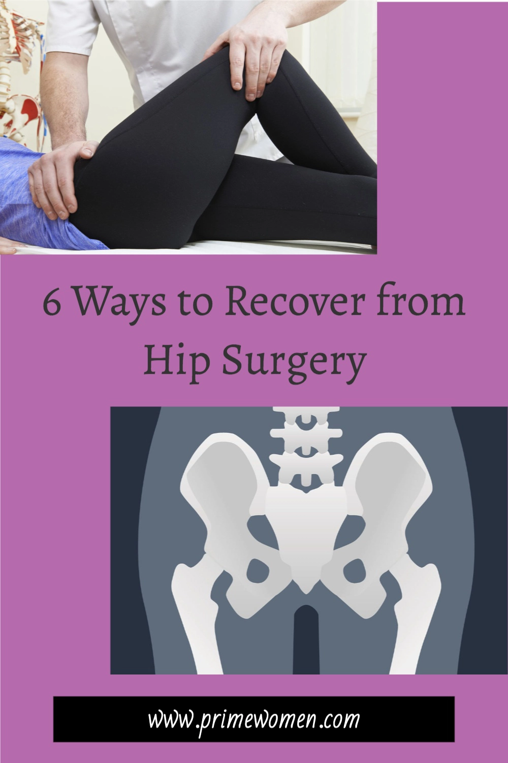 6 ways to recover from hip surgery
