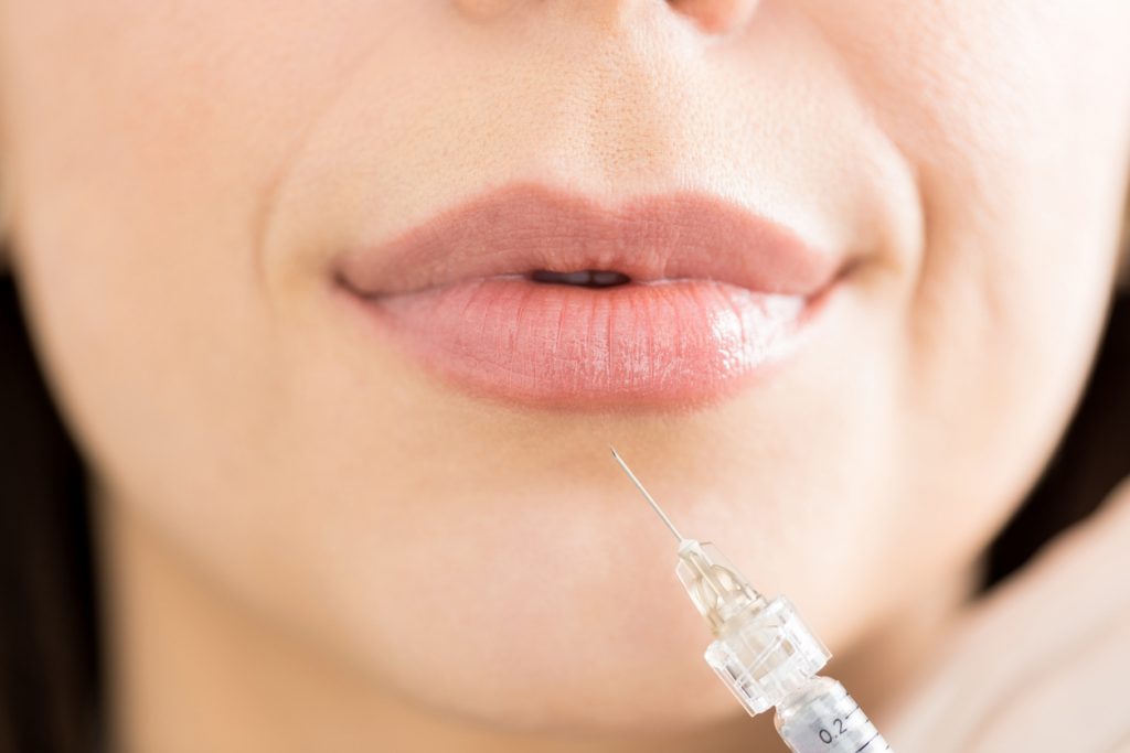 What Are The Best Fillers For The Face? | PrimeWomen.com