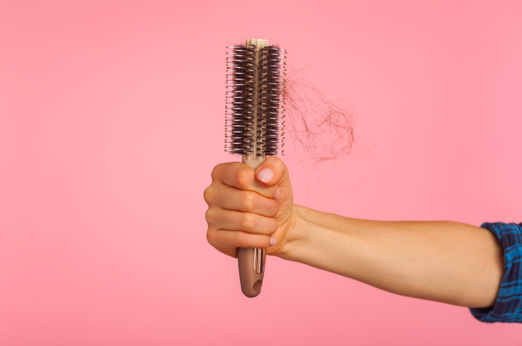 Let's Talk About Female Pattern Hair Loss | PRIMEWomen.com