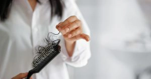 thinning hair