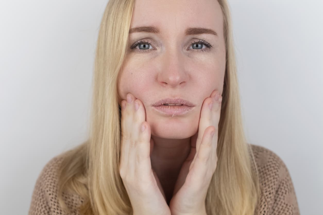 Woman with Dry skin from over-exfoliating