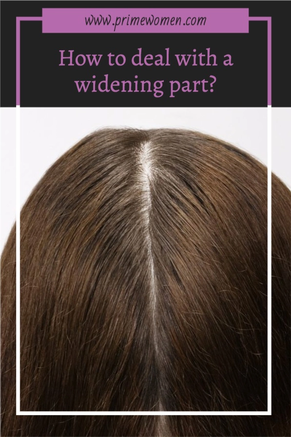 How to deal with a widening part caused by menopause