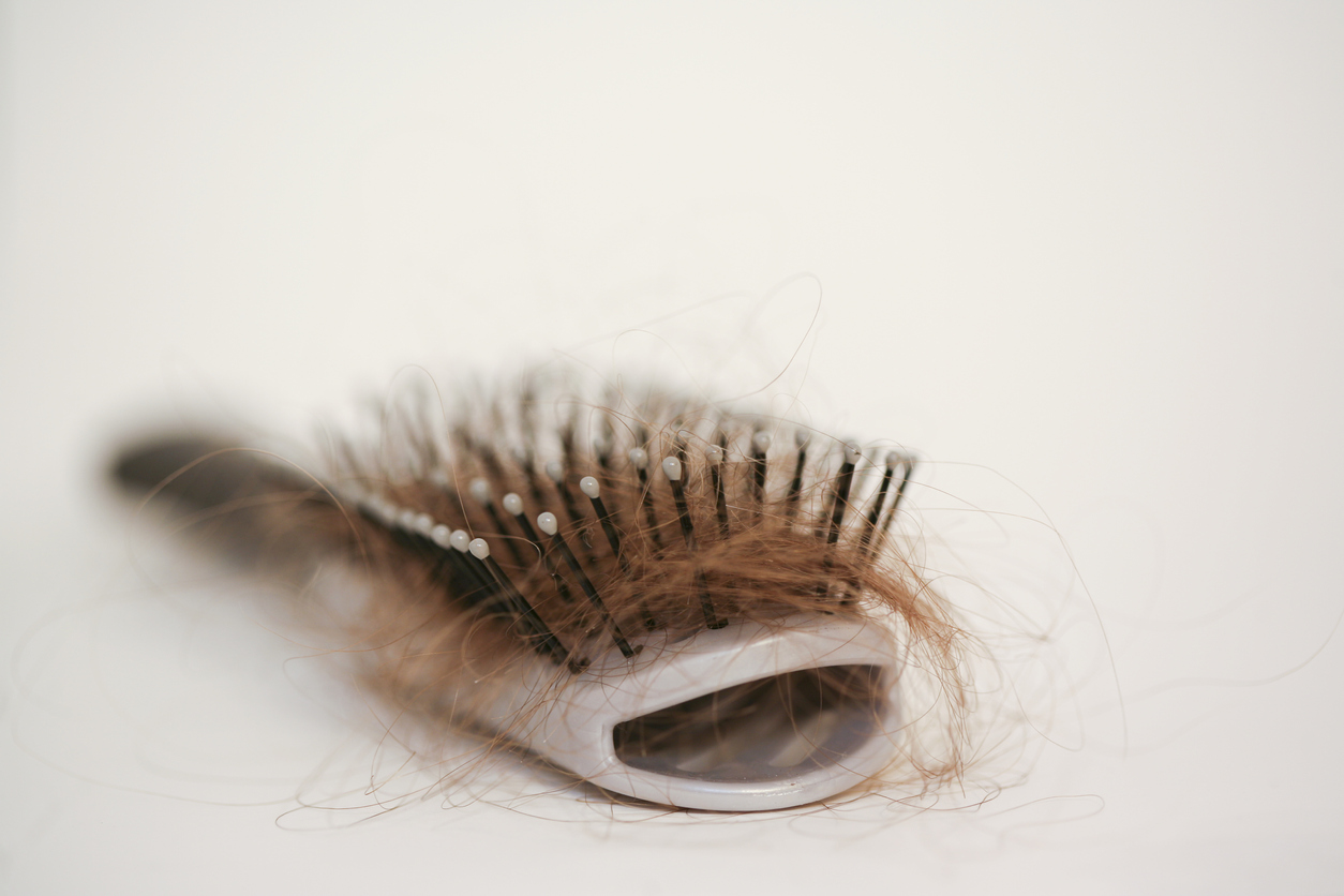 signs of hair loss