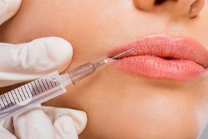 Lip Flip Procedure