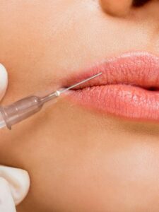 Do you need a Lip-Flip-procedure