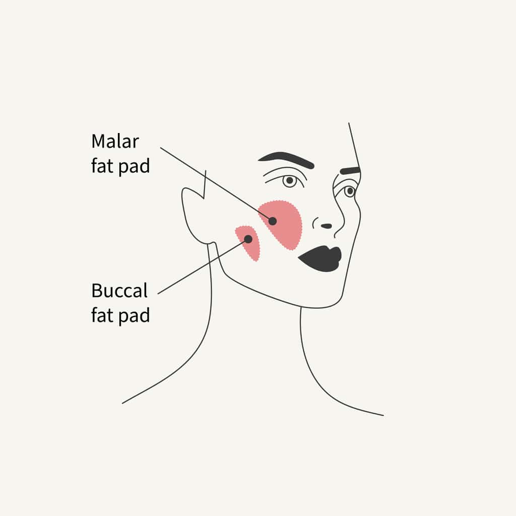 Buccal fat pad diagram