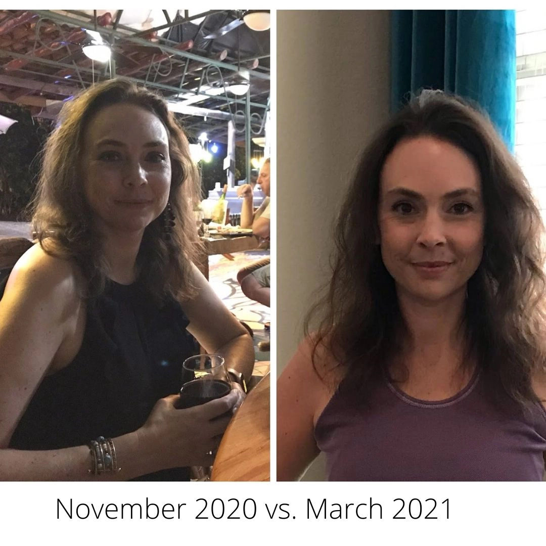 Before and After