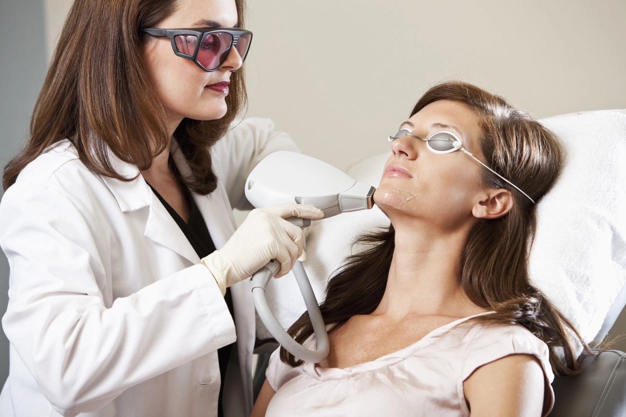Electrolysis and laser removal for chin hair
