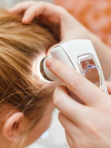 Dermatologist for hair loss