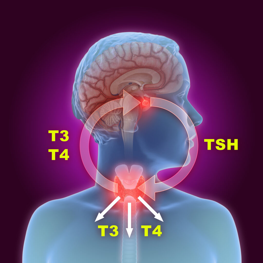 Hypothyroidism