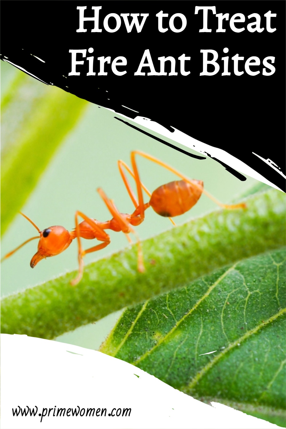 How-to-Treat-Fire-Ant-Bites