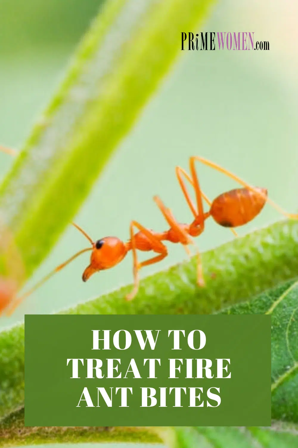How to treat fire ant bites