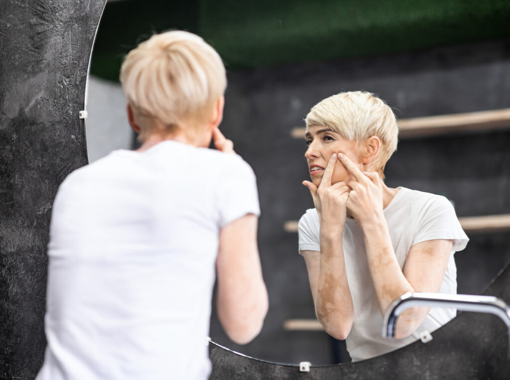 benzoyl peroxide and salicylic acid