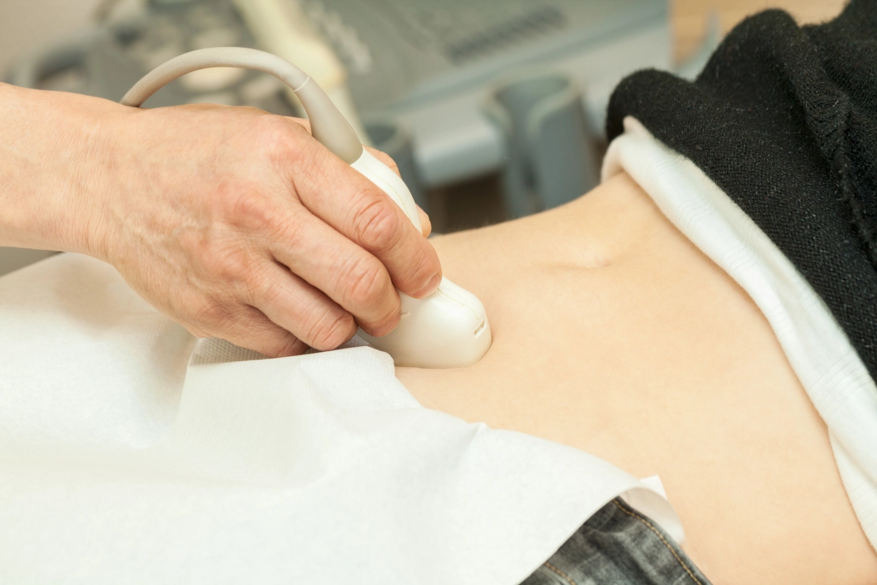 Woman getting an ultrasound to diagnose uterine prolapse