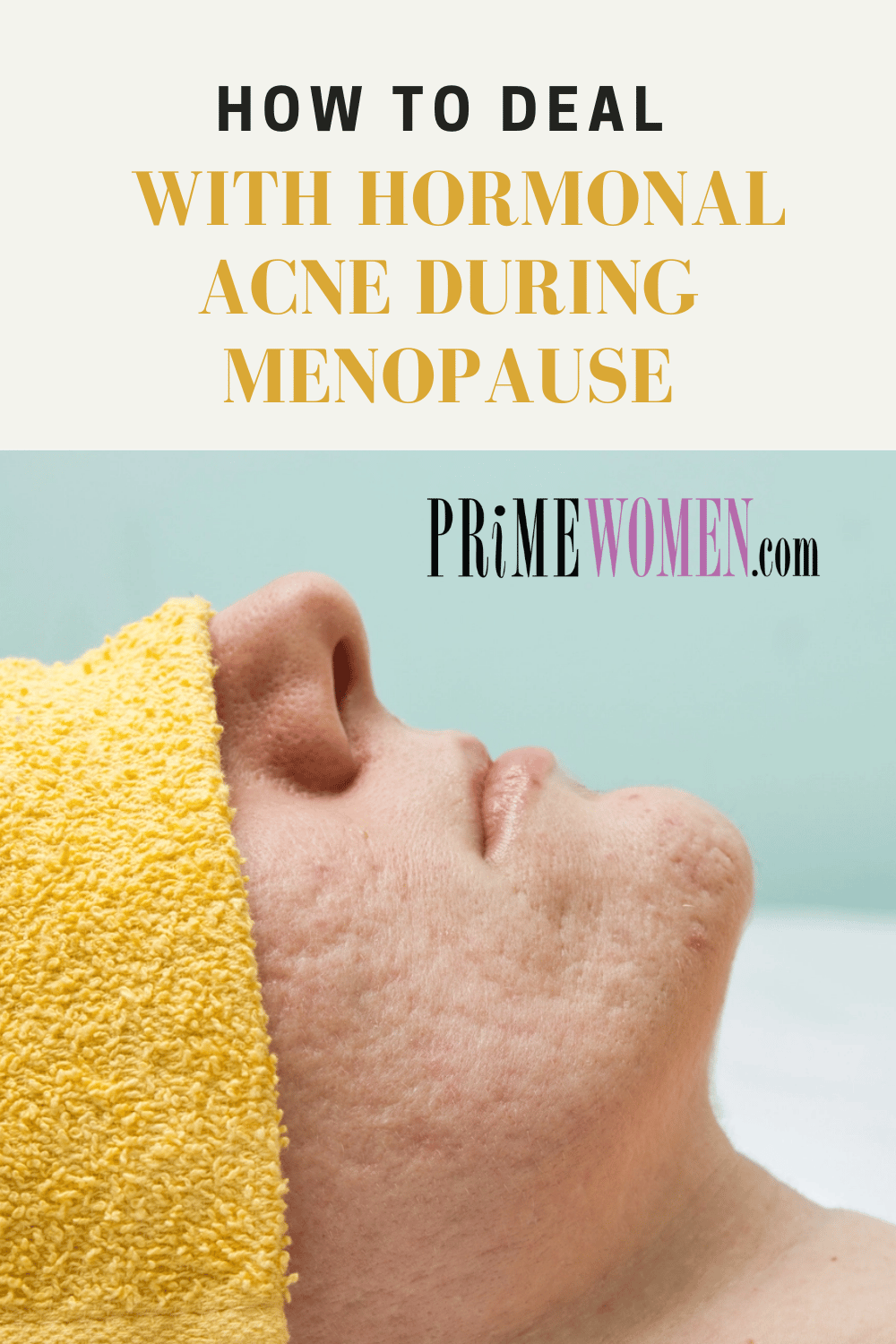 How to deal with homonal acne during menopause