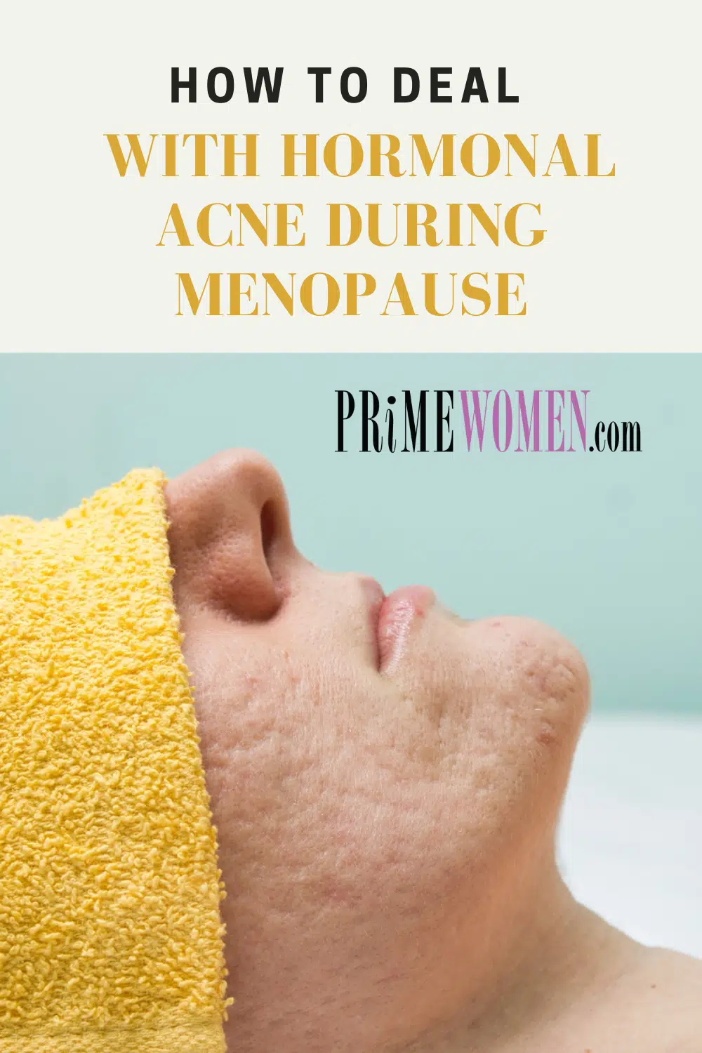 How to deal with homonal acne during menopause