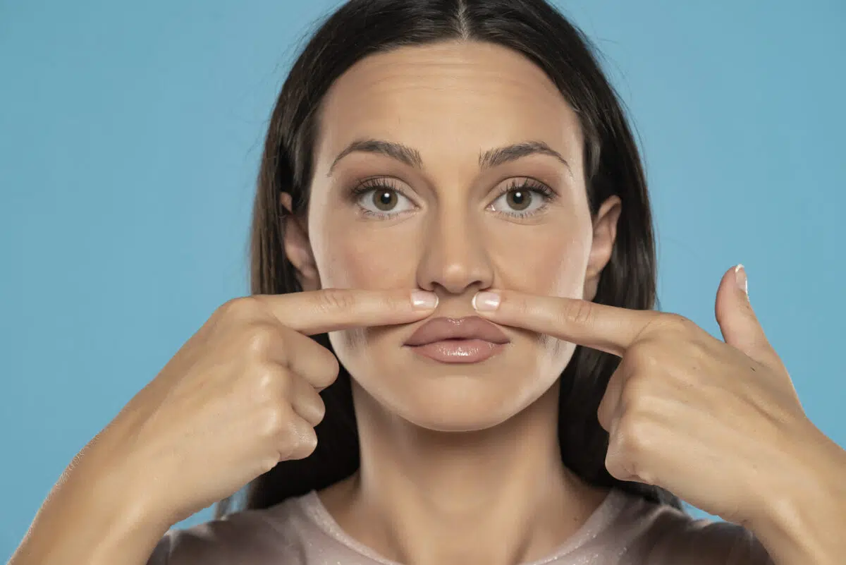 lip lift