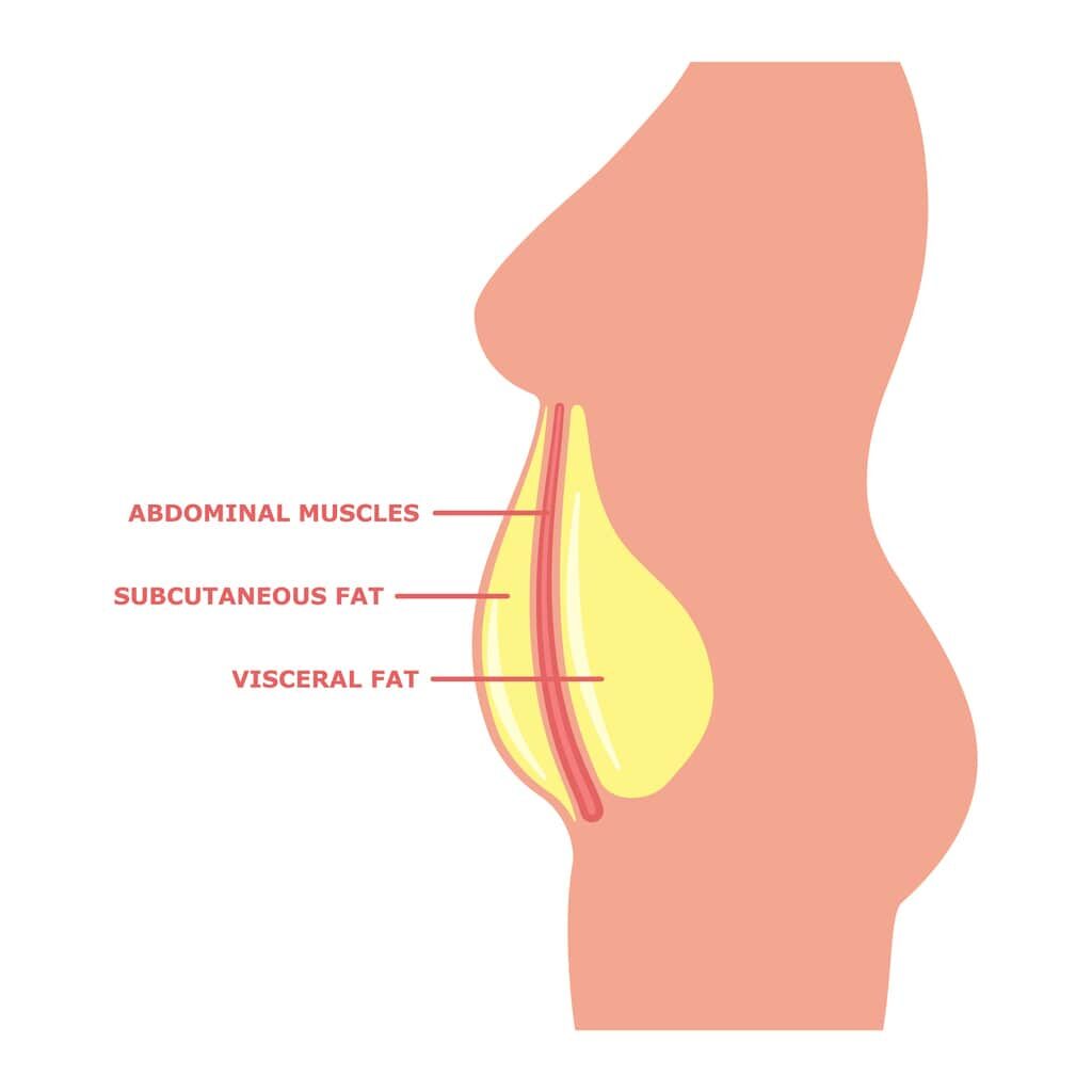 Subcutaneous fat vs visceral fat