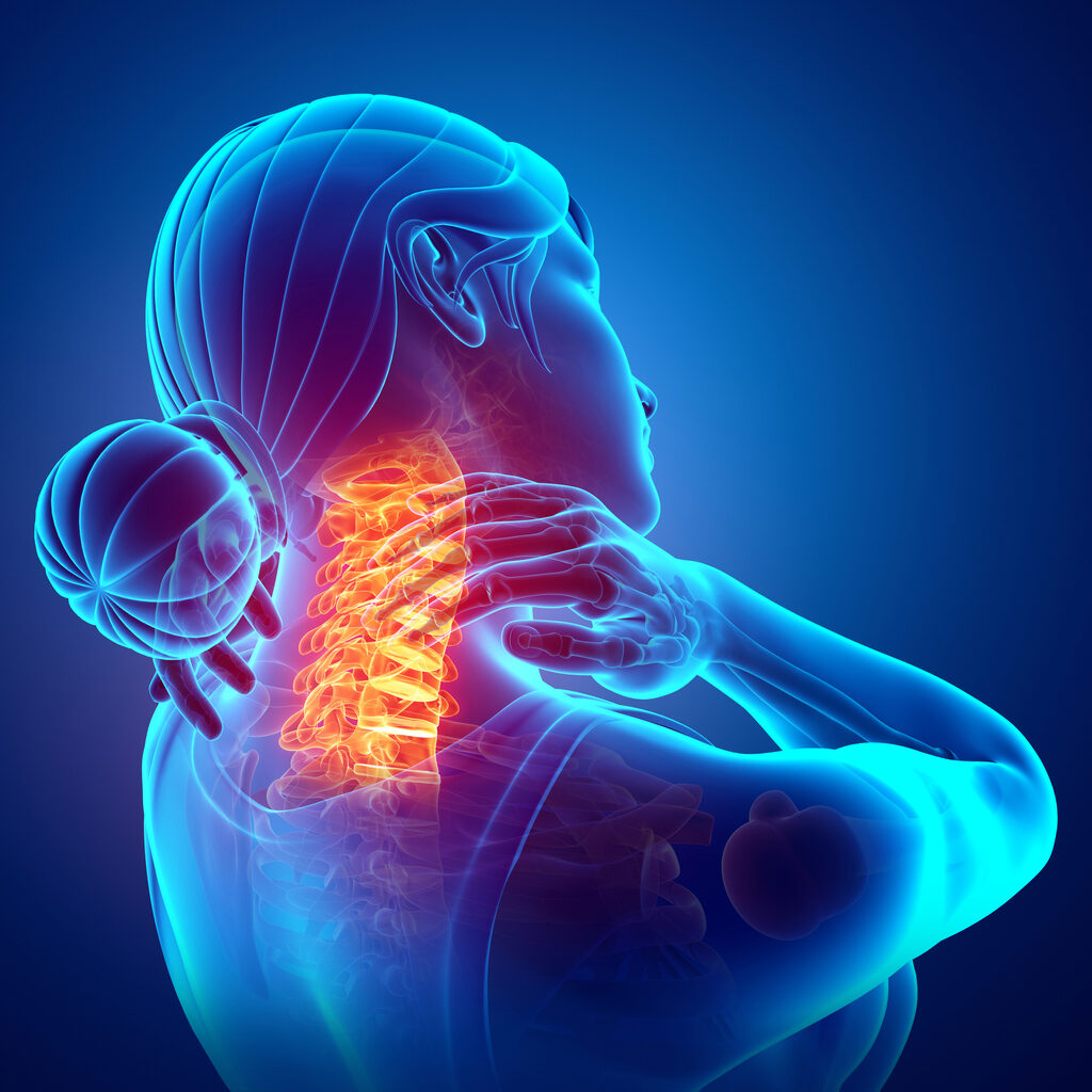 Neck pain