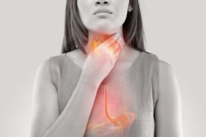 Acid reflux vs peptic ulcers