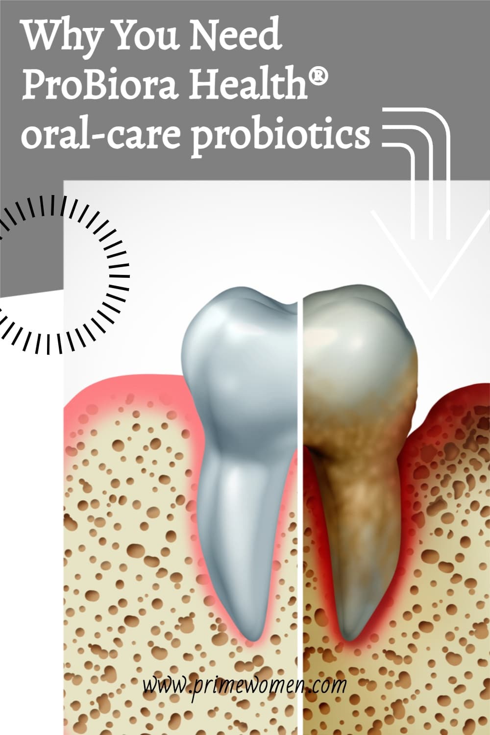 Why-You-Need-ProBiora-Health®-oral-care-probiotics