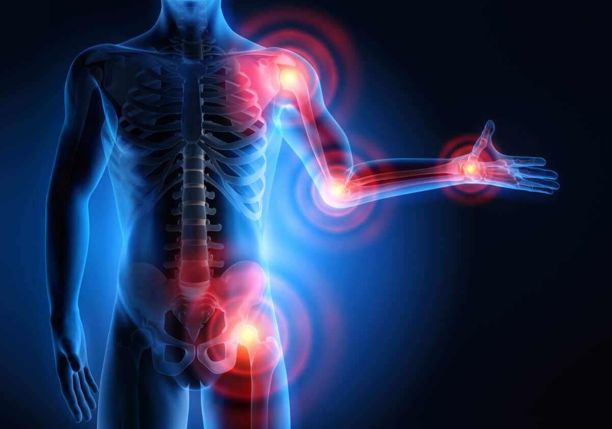 Joint inflammation - 3D rendering of joint pain