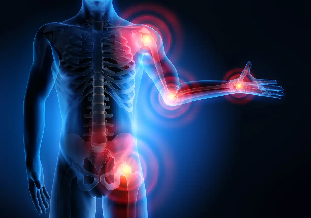 Joint inflammation - 3D rendering of joint pain