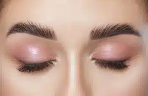 Woman with thick eyelashes transformed from thinning eyelashes